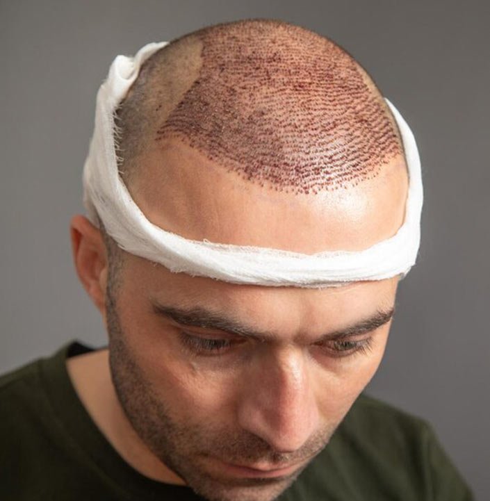 TRANSPLANTE QUE TRANSFORMA 02